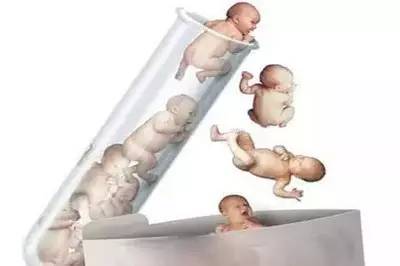 时差培养箱